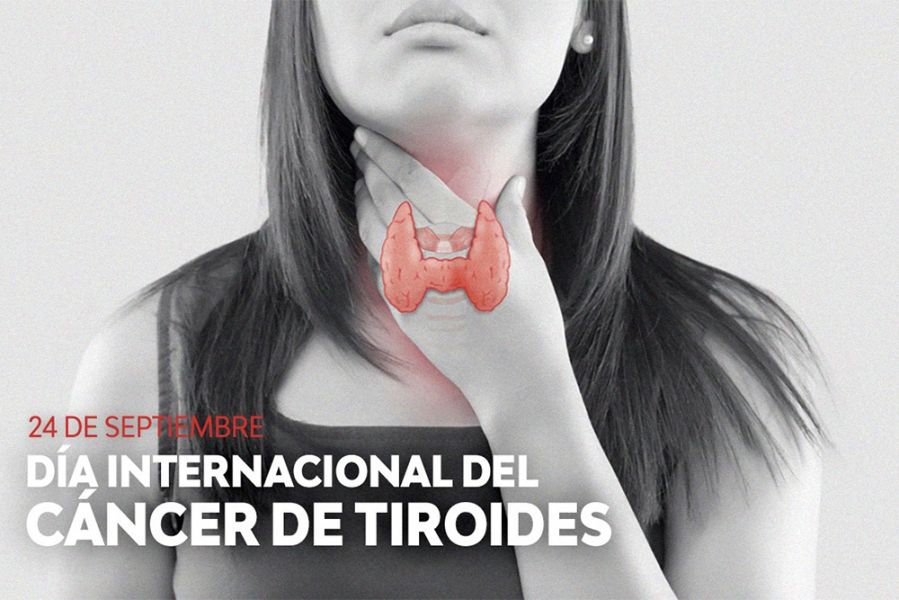 24 de septiembre: Día Mundial del Cáncer de Tiroides